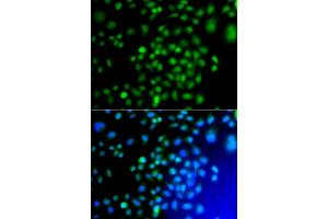 Immunofluorescence analysis of A549 cells using ATF7 antibody (ABIN5975307). (AFT7 anticorps)