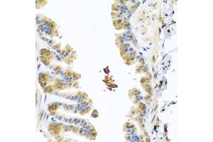 Immunohistochemistry of paraffin-embedded mouse lung using CHI3L2 antibody (ABIN5975154) at dilution of 1/100 (40x lens). (CHI3L2 anticorps)