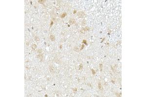 Immunohistochemistry of paraffin-embedded mouse spinal cord using MTAP Rabbit pAb (ABIN6132365, ABIN6144119, ABIN6144120 and ABIN6214763) at dilution of 1:50 (40x lens).