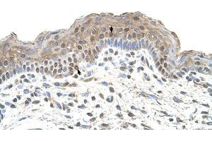 TAPBP antibody was used for immunohistochemistry at a concentration of 4-8 ug/ml to stain Squamous epithelial cells (arrows) in Human Skin. (TAPBP anticorps)