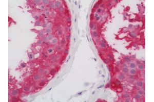 Human Testis: Formalin-Fixed, Paraffin-Embedded (FFPE). (ASB9 anticorps  (FITC))
