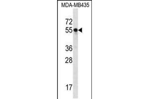 Western blot analysis in MDA-MB435 cell line lysates (35ug/lane). (SLC15A3 anticorps  (AA 168-197))