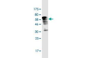 Western Blot detection against Immunogen (60.