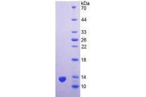 SDS-PAGE analysis of Human PSCA Protein. (PSCA Protéine)