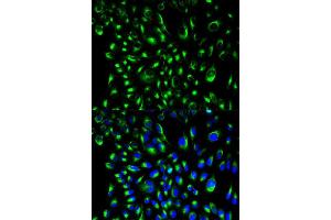 Immunofluorescence analysis of HeLa cell using LCP2 antibody. (LCP2 anticorps  (AA 284-533))