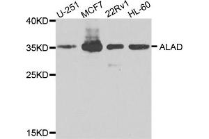 Western blot analysis of extracts of various cell lines, using ALAD antibody (ABIN5974581) at 1/1000 dilution. (ALAD anticorps)