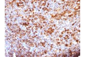 Immunohistochemical staining (Formalin-fixed paraffin-embedded sections) of human tonsil with IgG monoclonal antibody, clone B33/20 . (Souris anti-Humain Immunoglobulin Heavy Constant gamma 1 (G1m Marker) (IGHG1) Anticorps)