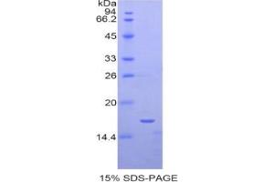 SDS-PAGE analysis of Human SIGLEC1 Protein.