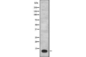 Western blot analysis of IGFL1 expression in Hela cell lysate,The lane on the left is treated with the antigen-specific peptide. (IGFL1 anticorps)