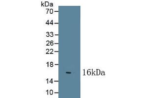 Detection of Recombinant NGF, Bovine using Polyclonal Antibody to Nerve Growth Factor (NGF) (Nerve Growth Factor anticorps  (AA 122-241))