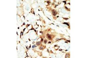 Image no. 2 for anti-Insulin Receptor (INSR) (N-Term) antibody (ABIN359886) (Insulin Receptor anticorps  (N-Term))