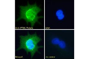 ABIN185555 Immunofluorescence analysis of paraformaldehyde fixed HepG2 cells, permeabilized with 0.