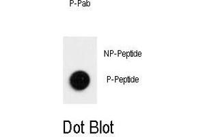 Dot blot analysis of Phospho-LC3 (G8b)- T12 Antibody 3530a on nitrocellulose membrane. (LC3B anticorps  (pThr12))