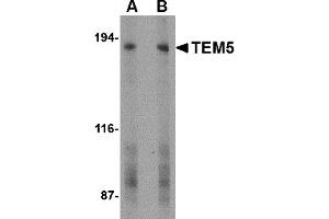 Western Blotting (WB) image for anti-G Protein-Coupled Receptor 124 (GPR124) (C-Term) antibody (ABIN1030729) (GPR124 anticorps  (C-Term))