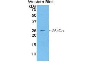 Western Blotting (WB) image for anti-Toll-Like Receptor Adaptor Molecule 2 (TICAM2) (AA 34-241) antibody (ABIN1860752) (TICAM2 anticorps  (AA 34-241))