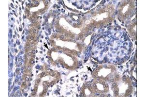 Image no. 1 for anti-KIN, Antigenic Determinant of RecA Protein Homolog (KIN) (AA 230-279) antibody (ABIN6735789)