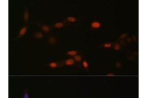 Immunofluorescence analysis of NIH-3T3 cells using MonoMethyl-Histone H3-K14 Polyclonal Antibody at dilution of 1:100 (40x lens).