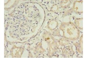 Immunohistochemistry of paraffin-embedded human kidney tissue using ABIN7171269 at dilution of 1:100 (STXBP6 anticorps  (AA 2-210))