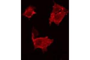 ABIN6266858 staining HeLa by IF/ICC. (BCAR3 anticorps  (C-Term))
