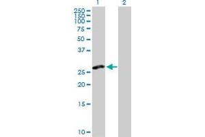 Western Blot analysis of CLEC2D expression in transfected 293T cell line by CLEC2D MaxPab polyclonal antibody. (CLEC2D anticorps  (AA 1-191))