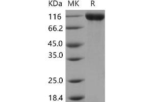 Western Blotting (WB) image for Contactin 2 (Axonal) (CNTN2) protein (His tag) (ABIN7320040)