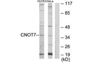Western blot analysis of extracts from HeLa/HuvEc cells, using CNOT7 Antibody.
