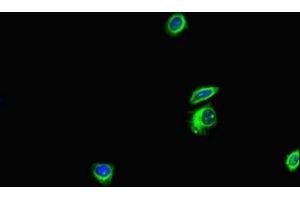 Immunofluorescent analysis of HepG2 cells using ABIN7144171 at dilution of 1:100 and Alexa Fluor 488-congugated AffiniPure Goat Anti-Rabbit IgG(H+L) (ANKS6 anticorps  (AA 1-132))