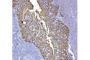 IHC analysis of MASPIN using anti-MASPIN antibody (ABIN7599298).
