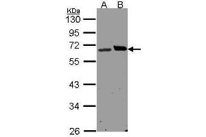 WB Image Sample(30 μg of whole cell lysate) A:H1299 B:Hep G2, 10% SDS PAGE antibody diluted at 1:1500 (RPN1 anticorps  (C-Term))