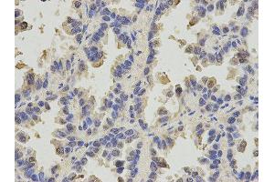 Immunohistochemistry (IHC) image for anti-Solute Carrier Family 4, Sodium Bicarbonate Cotransporter, Member 4 (SLC4A4) antibody (ABIN1876520) (SLC4A4 anticorps)