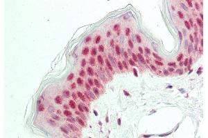 Rabbit Anti-POU2F3 antibody  Formalin Fixed Paraffin Embedded Tissue: Human Skin Primary antibody Concentration: 1:200 Secondary Antibody: Donkey anti-Rabbit-Cy3 Secondary Antibody Concentration: 1:200 Magnification: 20x Exposure Time: 0.