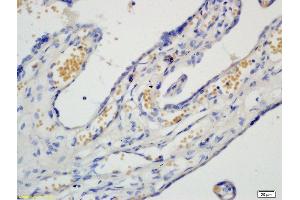 Formalin-fixed and paraffin embedded human placenta tissue labeled with Rabbit Anti-PAF Polyclonal Antibody, Unconjugated (ABIN737931) 1:200 followed by conjugation to the secondary antibody and DAB staining