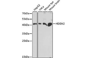 Western blot analysis of extracts of various cell lines, using HEXIM2 antibody (ABIN7267637) at 1:1000 dilution. (HEXIM2 anticorps  (AA 147-286))
