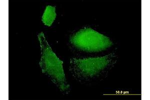 Immunofluorescence of monoclonal antibody to VAMP1 on HepG2 cell.