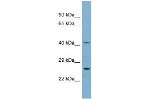 WB Suggested Anti-MRPS2 Antibody Titration: 0.