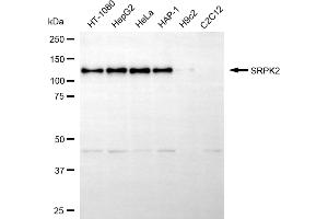 Western blotting analysis using SRPK2 antibody (ABIN7800327). (SRPK2 anticorps)