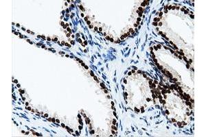 Image no. 4 for anti-5'-Nucleotidase Domain Containing 1 (NT5DC1) antibody (ABIN1499838)
