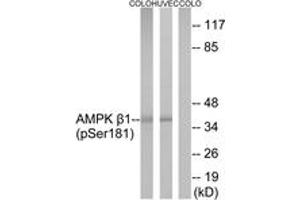 Western blot analysis of extracts from COLO205 cells and HuvEc cells, using AMPK beta1 (Phospho-Ser181) Antibody.
