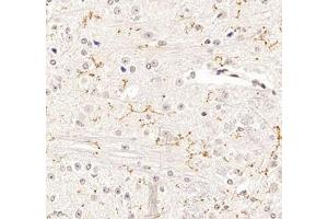 Immunohistochemistry of paraffin embedded mouse spinal cord using P2Y12 (ABIN7075321) at dilution of 1: 1400 (400x lens)