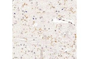 Immunohistochemistry of paraffin embedded mouse spinal cord using P2Y12 (ABIN7075321) at dilution of 1: 1400 (400x lens) (P2RY12 anticorps)