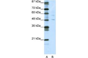 WB Suggested Anti-PLAGL1 Antibody Titration:  5.