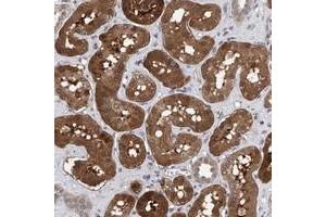 Immunohistochemical staining of human kidney with C9orf97 polyclonal antibody  shows strong cytoplasmic and nuclear positivity in proximal tubules at 1:50-1:200 dilution. (TSTD2 anticorps)