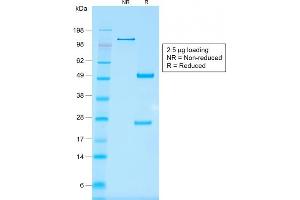 SDS-PAGE Analysis Purified EpCAM Mouse Recombinant Monoclonal Antibody (rMOC-31).