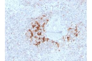 Formalin-fixed, paraffin-embedded human Spleen stained with TRAF1 Mouse Monoclonal Antibody (TRAF1/3298). (TRAF1 anticorps  (AA 73-219))