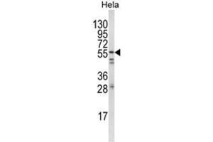 Western blot analysis of FYN Antibody (N-term) in Hela cell line lysates (35ug/lane). (FYN anticorps  (N-Term))