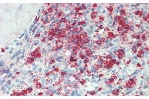 Detection of IL22Ra2 in Human Spleen Tissue using Polyclonal Antibody to Interleukin 22 Receptor Alpha 2 (IL22Ra2) (IL22RA2 anticorps  (AA 31-223))