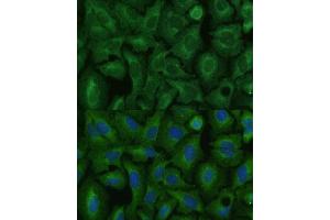 Immunofluorescence analysis of U-2 OS cells using TIMM8B Polyclonal Antibody (ABIN7270928) at dilution of 1:100 (40x lens).