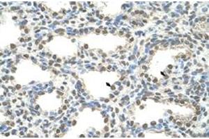 Immunohistochemical staining (Formalin-fixed paraffin-embedded sections) of human lung with FOXQ1 polyclonal antibody  at 4-8 ug/mL working concentration. (FOXQ1 anticorps  (N-Term))