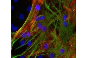 Indirect immunostaining of cultured PFA fixed rat astrocytes with anti-MCT 1 (dilution 1 : 500; red) and mouse anti-GFAP (cat.