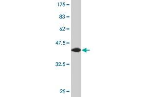 Western Blot detection against Immunogen (44. (AGR2 anticorps  (AA 1-175))